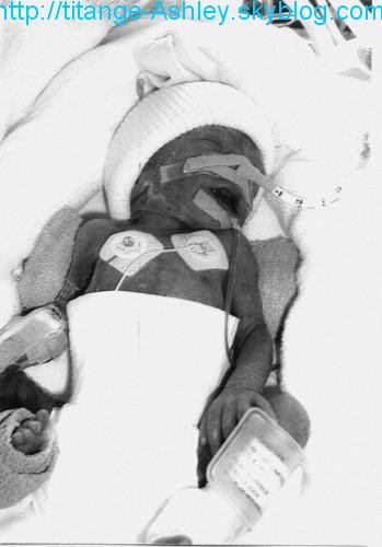 Voila je montre mon bout  nez 